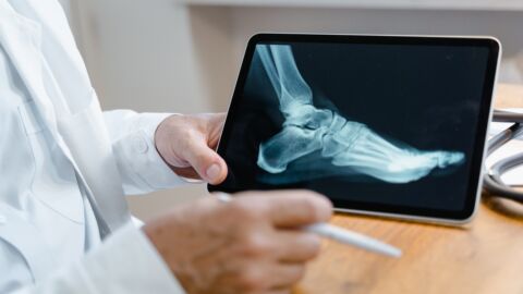 Vorschau-Bild zu Secur-e-Health – Smart Fracture Care